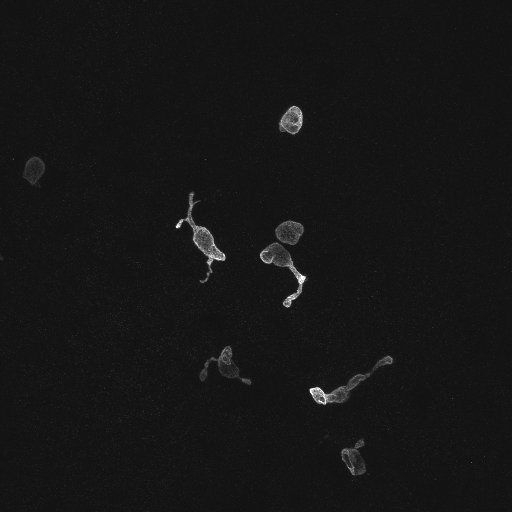 MAX_CC10-1924-0004-BSND-Ionocytes.jpg