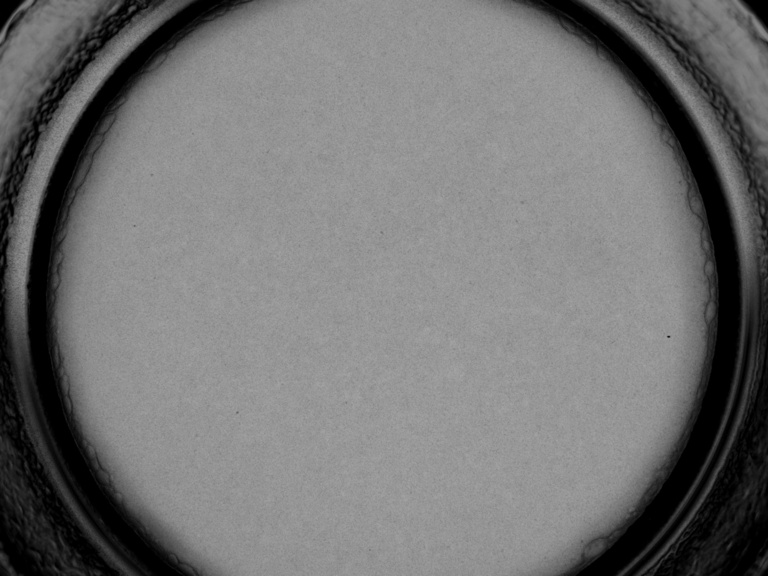 2x-view-of-cells-on-a-transwell.jpg